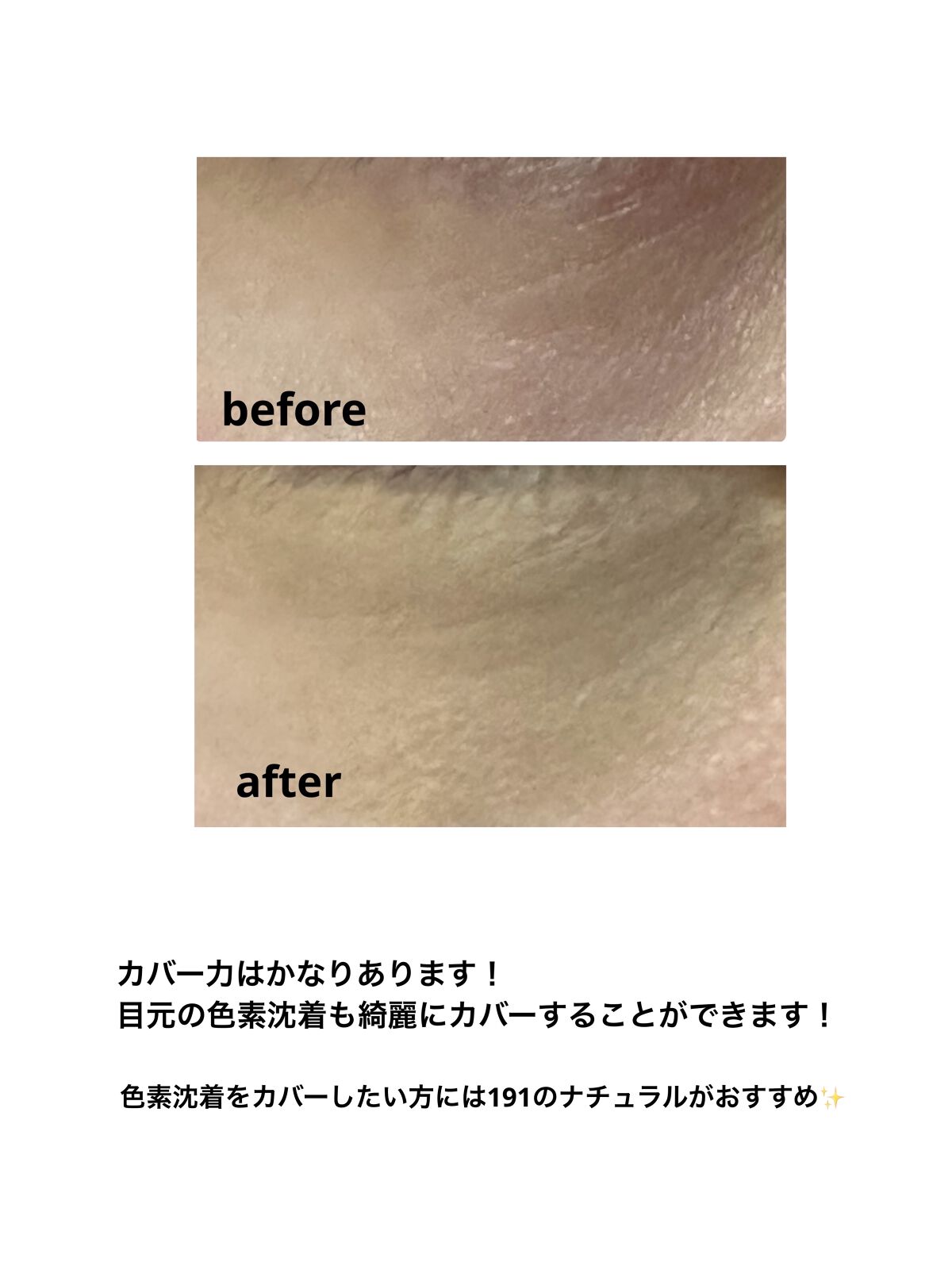 クレヨンコンシーラー 191 ナチュラル/チャコット・コスメティクス/ペンシルコンシーラーを使ったクチコミ（3枚目）