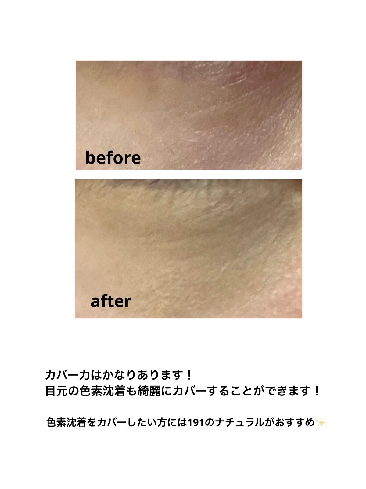 クレヨンコンシーラー/チャコット・コスメティクス/ペンシルコンシーラーを使ったクチコミ(3枚目)