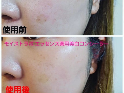 モイストラボ エッセンス薬用美白コンシーラー/Moist Labo/リキッドコンシーラーを使ったクチコミ(4枚目)