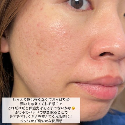 ナチュラルハーブ リコリス スージング パッド/SKINFOOD/トナーパッドを使ったクチコミ(9枚目)