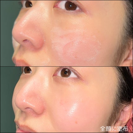 ペプチド ボリューム リフティングプロエッセンス/DR.PEPTI/美容液を使ったクチコミ(5枚目)