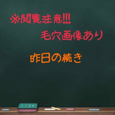 ロゼット 洗顔パスタ ガスールブライト/ロゼット/洗顔フォームを使ったクチコミ（1枚目）