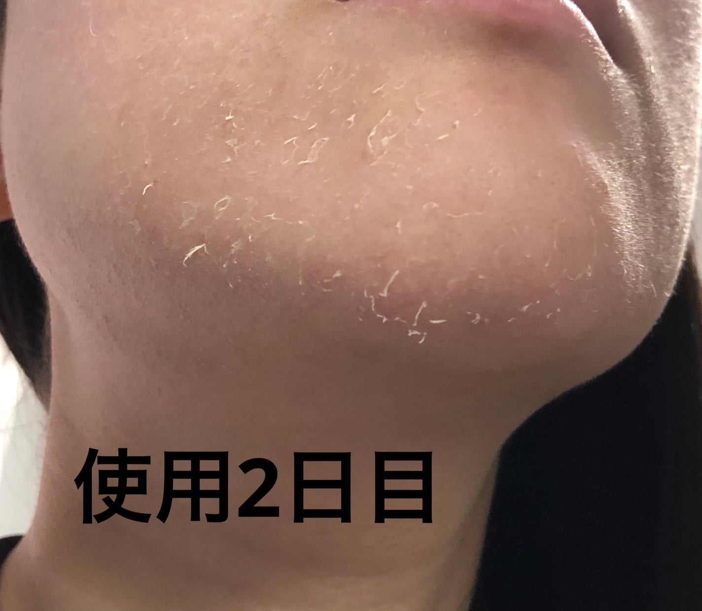 レチノールA 1% アドバンスドリバイタリゼーションクリーム/Life-flo/フェイスクリームを使ったクチコミ(4枚目)