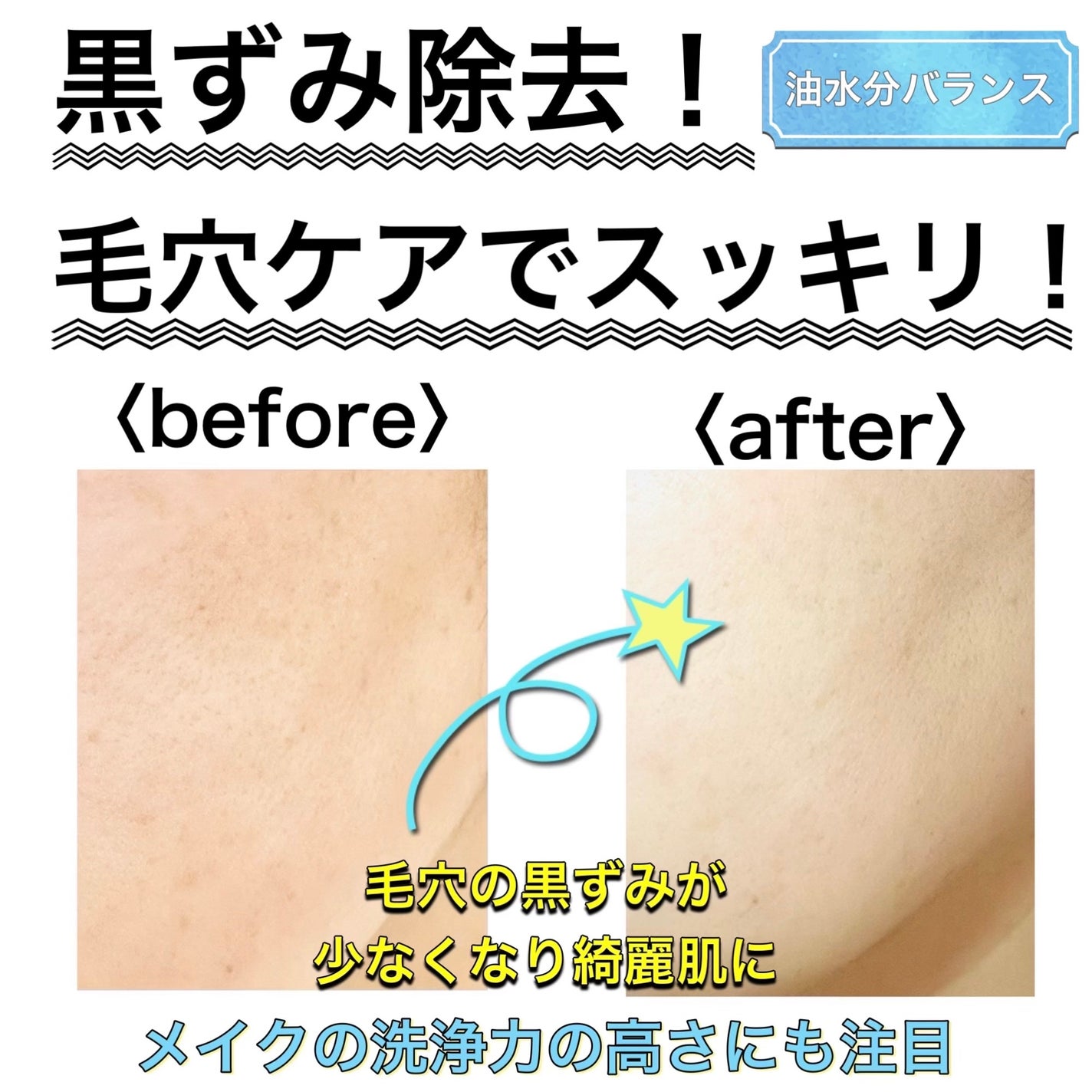 ILSO デュアルクリーンブラシ/ilso/その他スキンケアグッズを使ったクチコミ(3枚目)