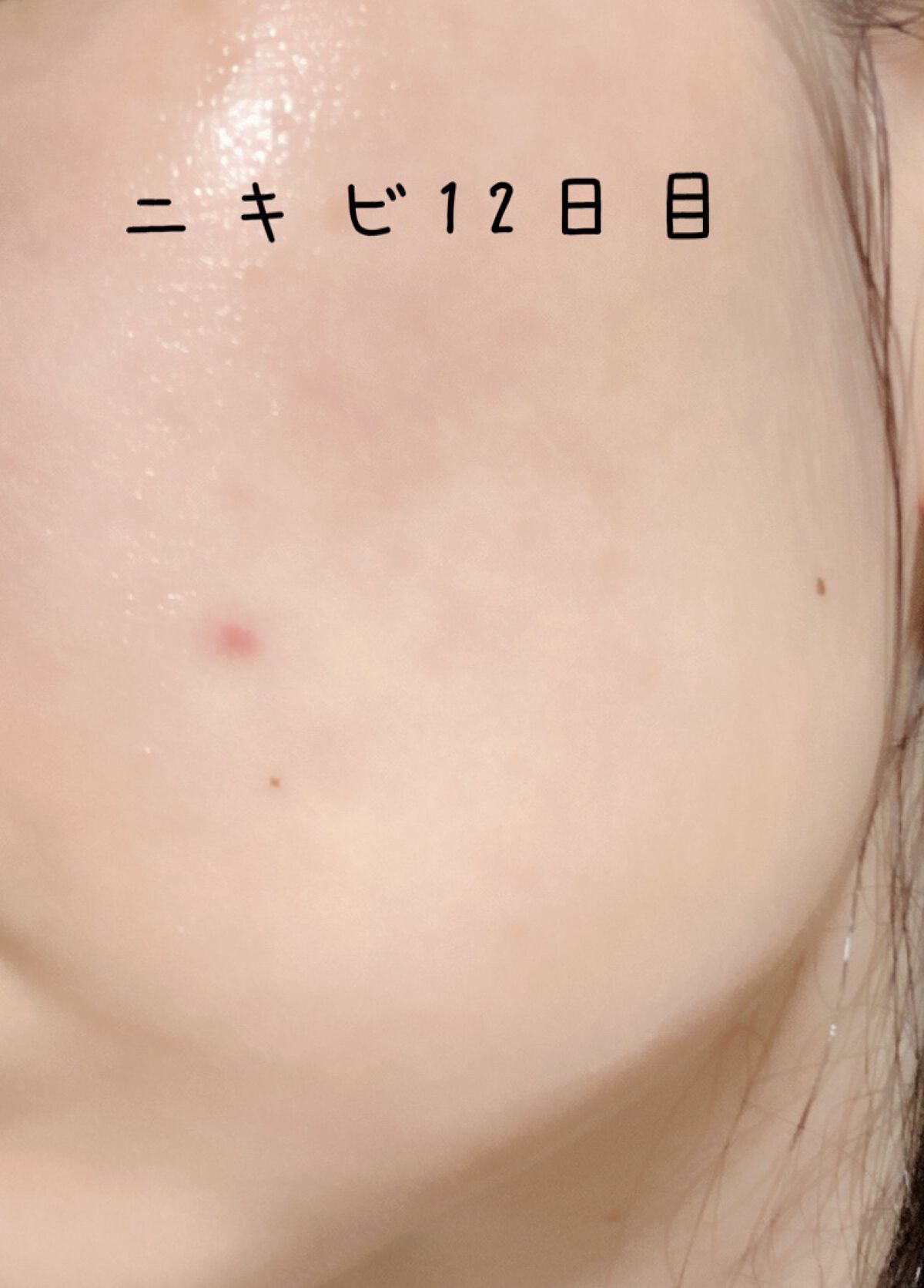 ブライトニングケア ローション RM（医薬部外品）/アクアレーベル/化粧水を使ったクチコミ（1枚目）