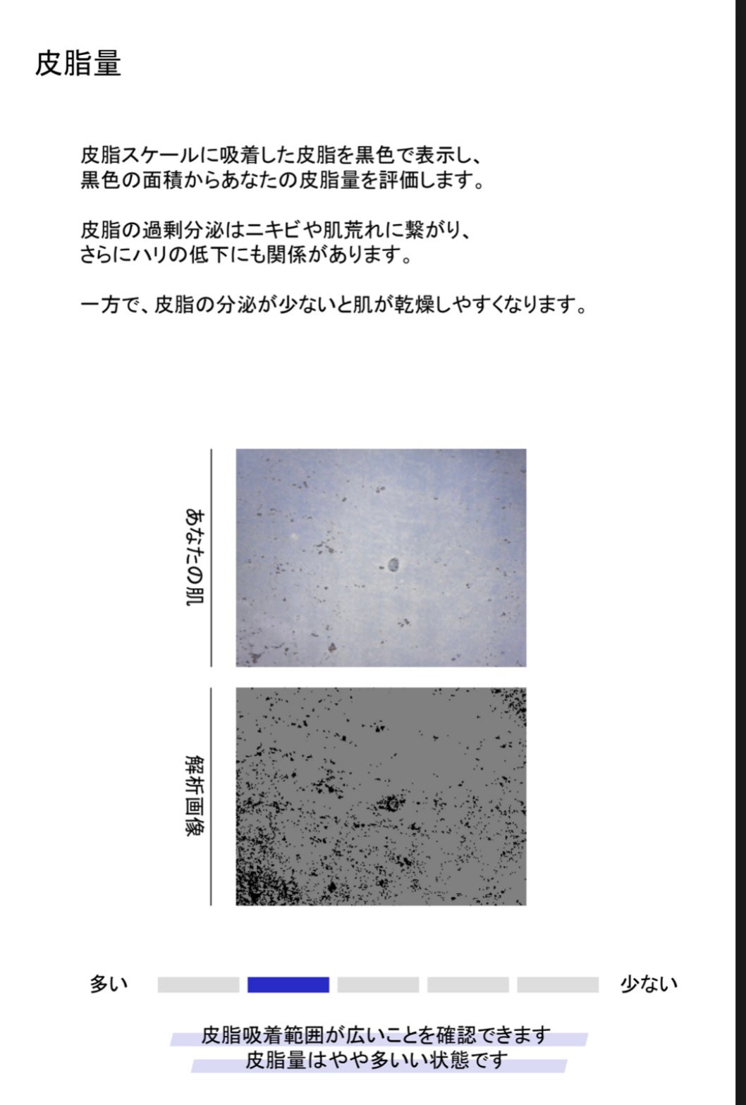 skin analysis kit(肌診断キット)/COCO.skin/その他スキンケアを使ったクチコミ(7枚目)