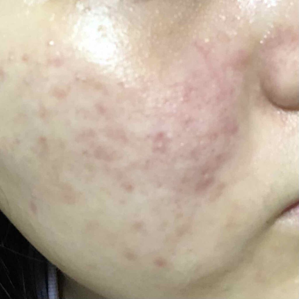 パワーマスク SP/ラッシュ/スクラブ・ゴマージュを使ったクチコミ（2枚目）