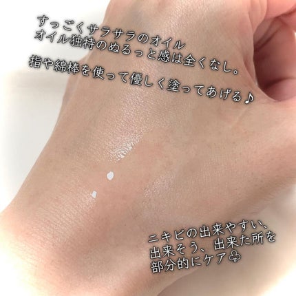 THE BODY SHOP ティーツリー オイルのクチコミ「\ ニキビができたらコレ🌿/
#THEBODYSHOP
オイルTT
10㎖ ¥1,870(税.....」(3枚目)