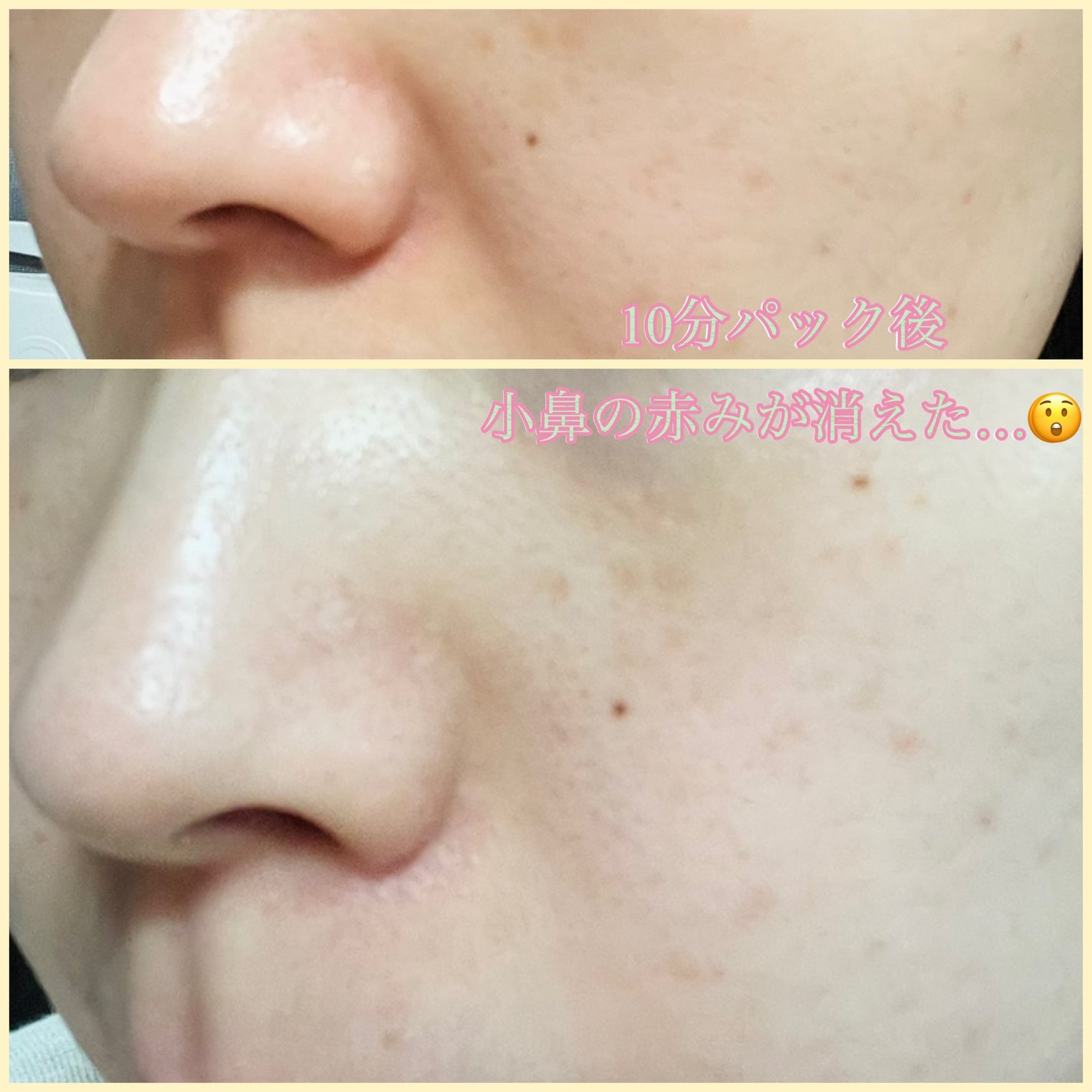 ピュアアルテミシアカーミングパッド/HANYUL(ハンユル)/トナーパッドを使ったクチコミ(1枚目)