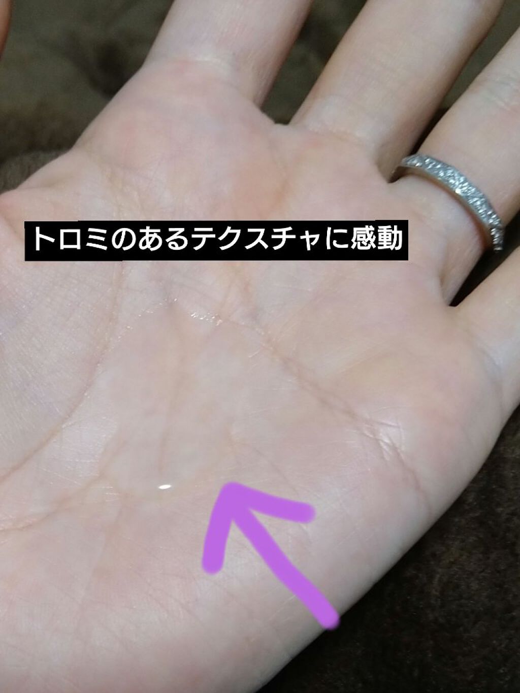 エファクラ ピールケア セラム/ラ ロッシュ ポゼ/美容液を使ったクチコミ（3枚目）