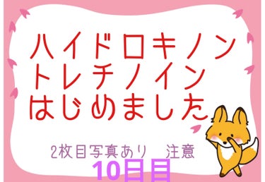 らん♥コスメ、シミケア観察 on LIPS 「10日目いっっっっったすぎてパックができませんでした(ᐡ′̥̥..」（1枚目）