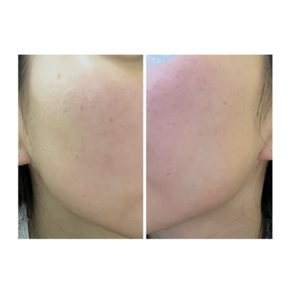 を使ったクチコミ(3枚目)