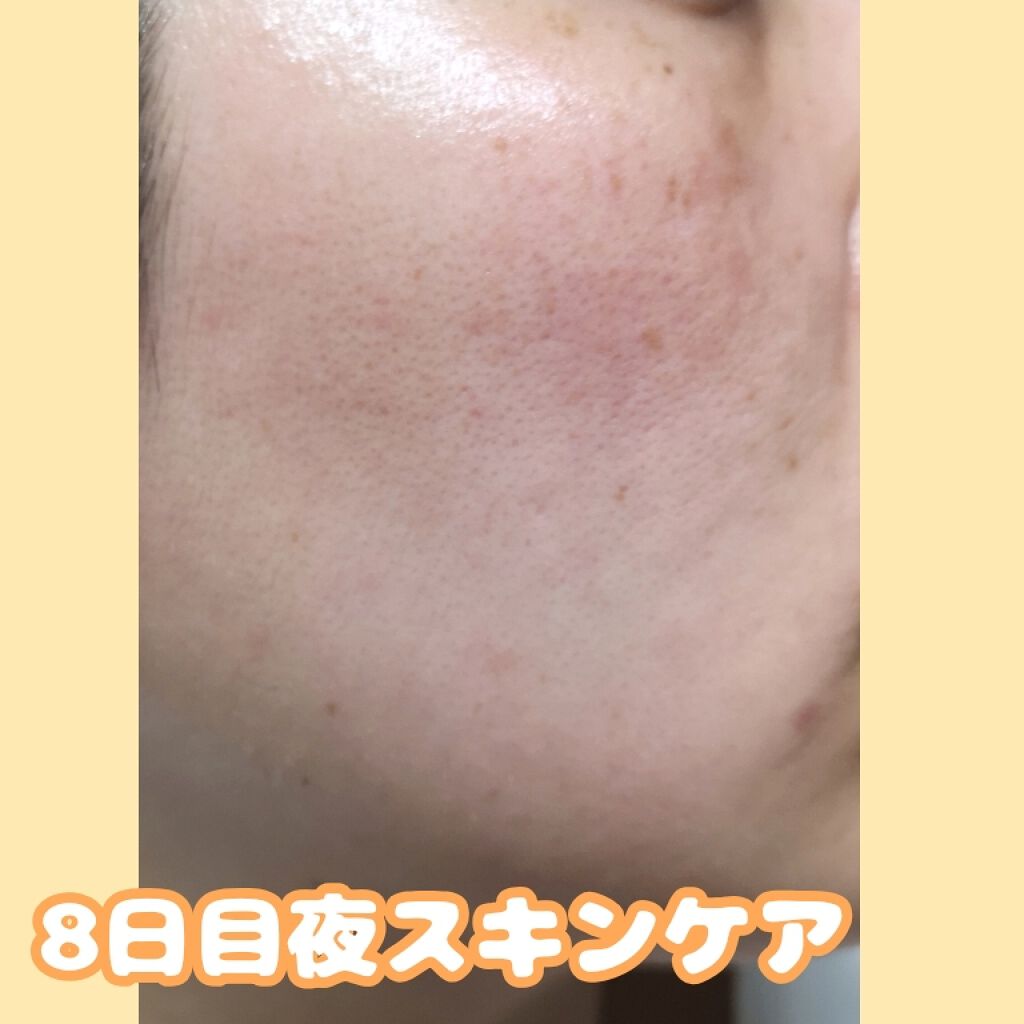 アレルバリア エッセンス BB/d プログラム/BBクリームを使ったクチコミ(4枚目)