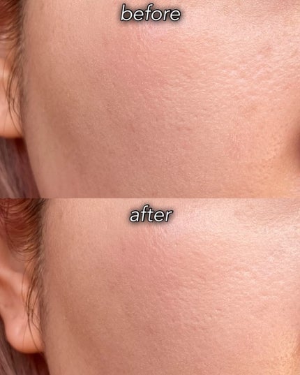 グラインディングコンシールバター/LUNA/クリームコンシーラーを使ったクチコミ(5枚目)