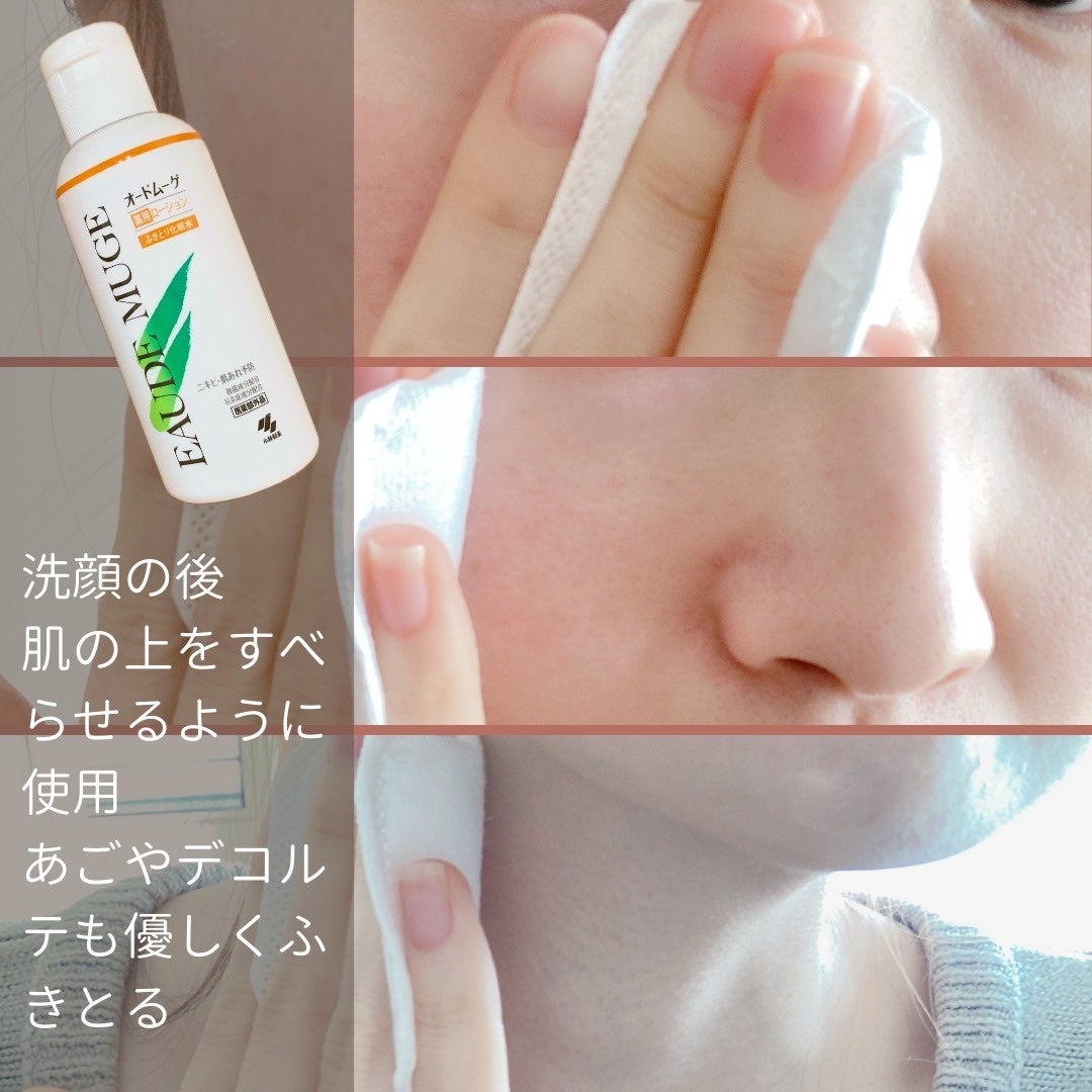 オードムーゲ 薬用ローション(ふきとり化粧水)/オードムーゲ/拭き取り化粧水を使ったクチコミ(3枚目)