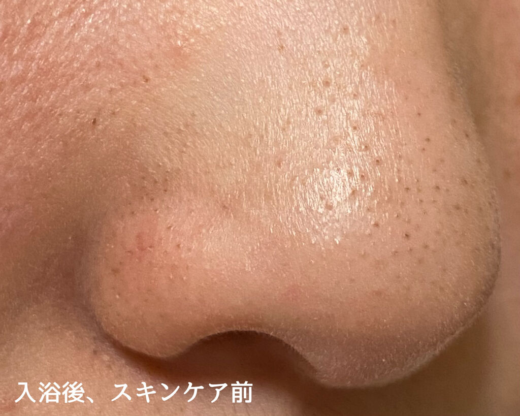 3ステップソクソクノーズパック/MEDIHEAL/シートマスク・パックを使ったクチコミ（2枚目）