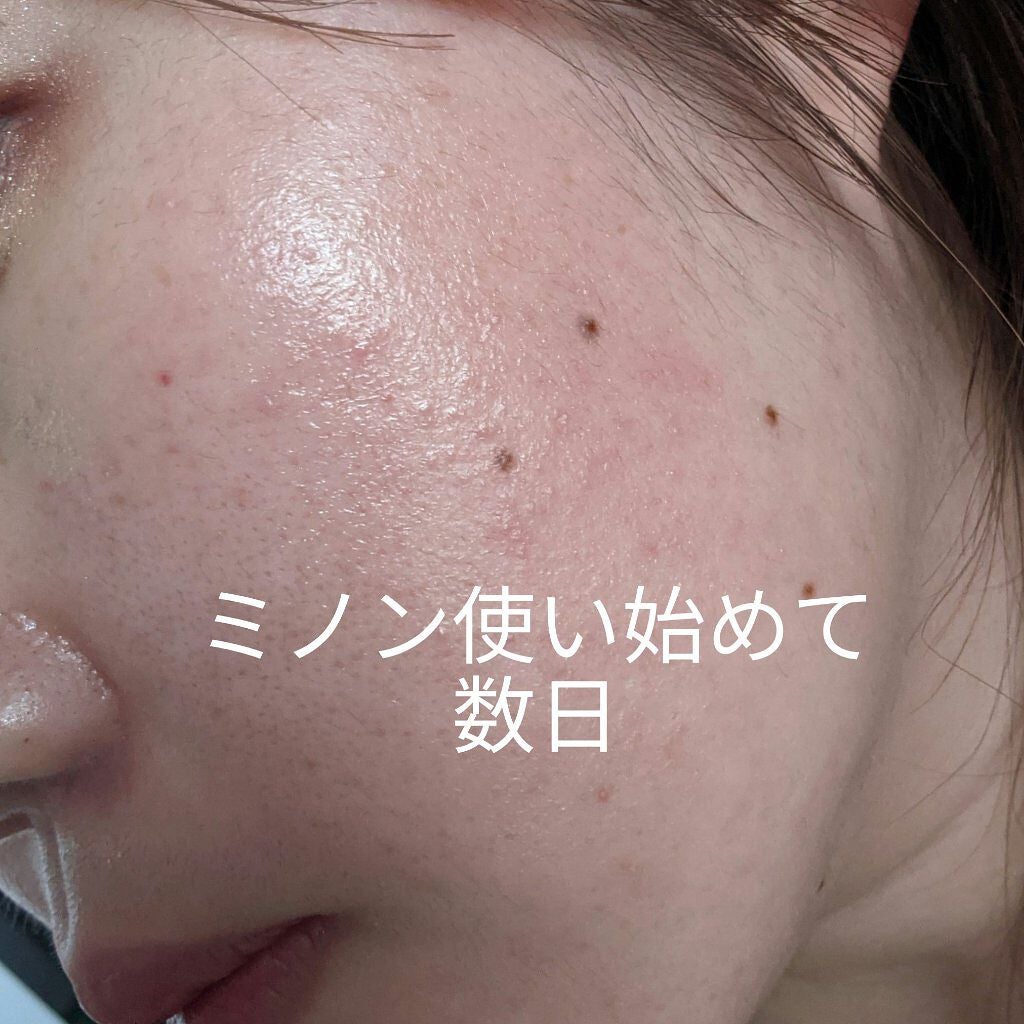 ミノン アミノモイスト ジェントルウォッシュ ホイップ/ミノン/泡洗顔を使ったクチコミ(1枚目)