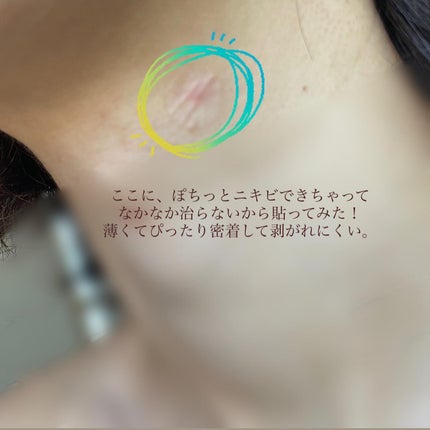 ごめんね素肌 キニシナイパッチ/クリアターン/シートマスク・パックを使ったクチコミ(4枚目)