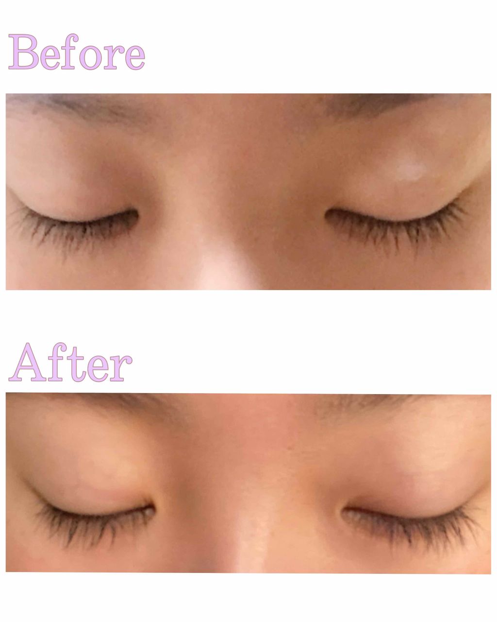 エグータム/アルマダスタイル/まつげ美容液を使ったクチコミ（2枚目）