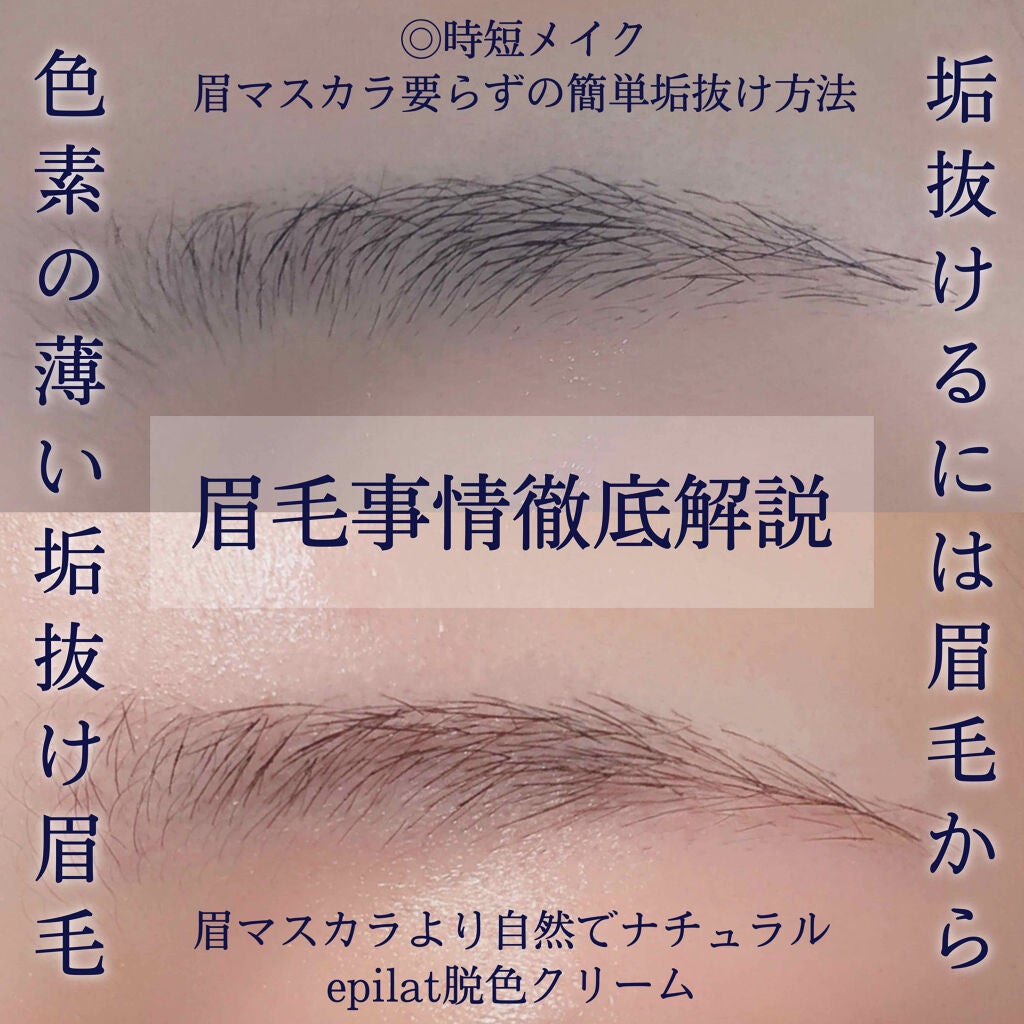 脱色クリーム スピーディー/エピラット/ムダ毛ケアを使ったクチコミ(1枚目)