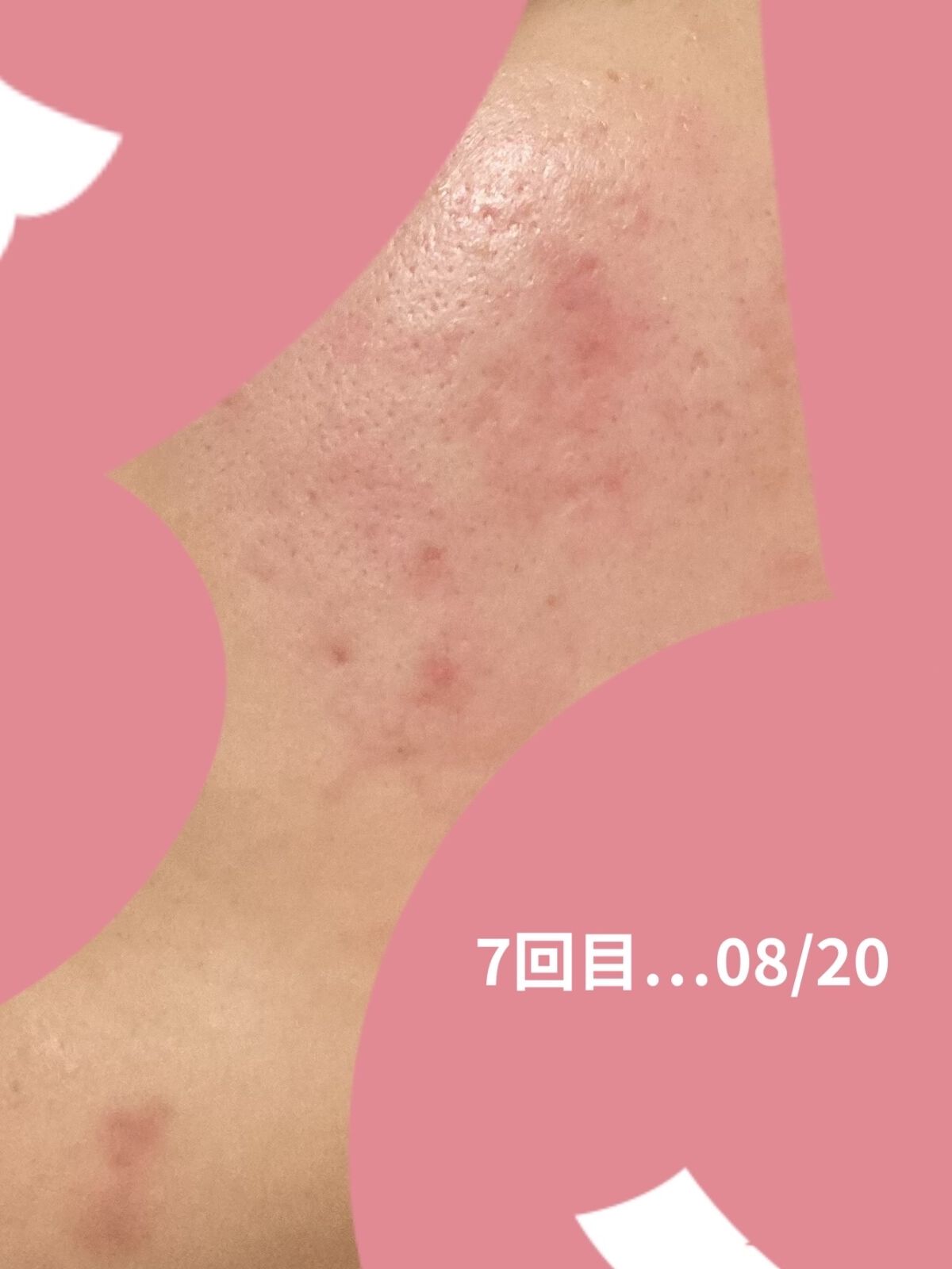 もち肌コラーゲンセラム3.0/MEDICUBE/美容液を使ったクチコミ（2枚目）