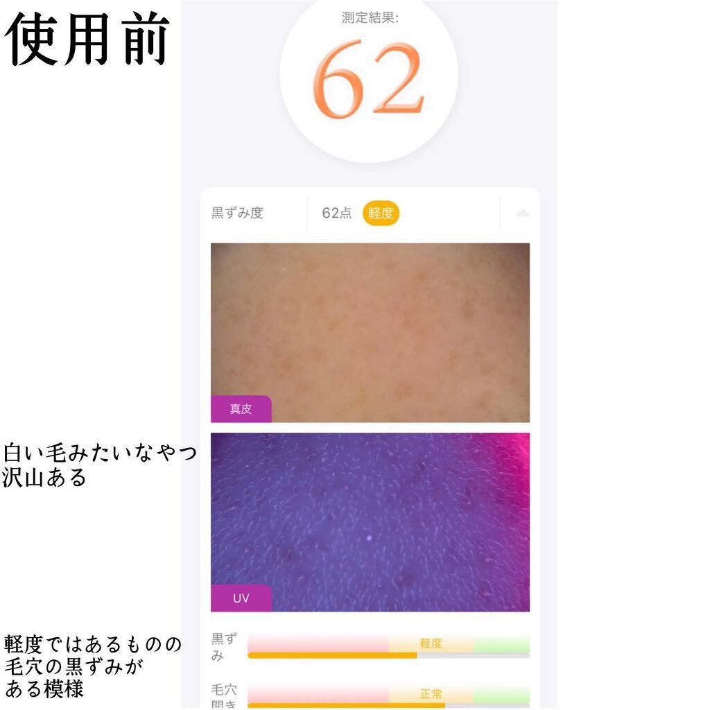 ゼロ毛穴パッド 2.0/MEDICUBE/トナーパッドを使ったクチコミ（2枚目）