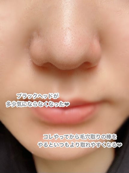 ごんす@YouTube始めました on LIPS 「《パチパチ炭酸コットンで毛穴キュッ❤︎》ドンキで安く売ってたか..」(7枚目)