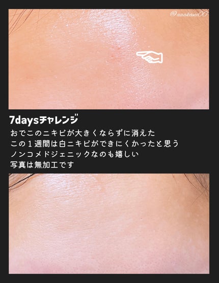 スネイルムチン95+ペプチドフェイシャルエッセンス/JUMISO/美容液を使ったクチコミ(4枚目)