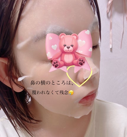 ダーマレーザー スーパー VC100 ホワイトマスク/クオリティファースト/シートマスク・パックを使ったクチコミ(4枚目)