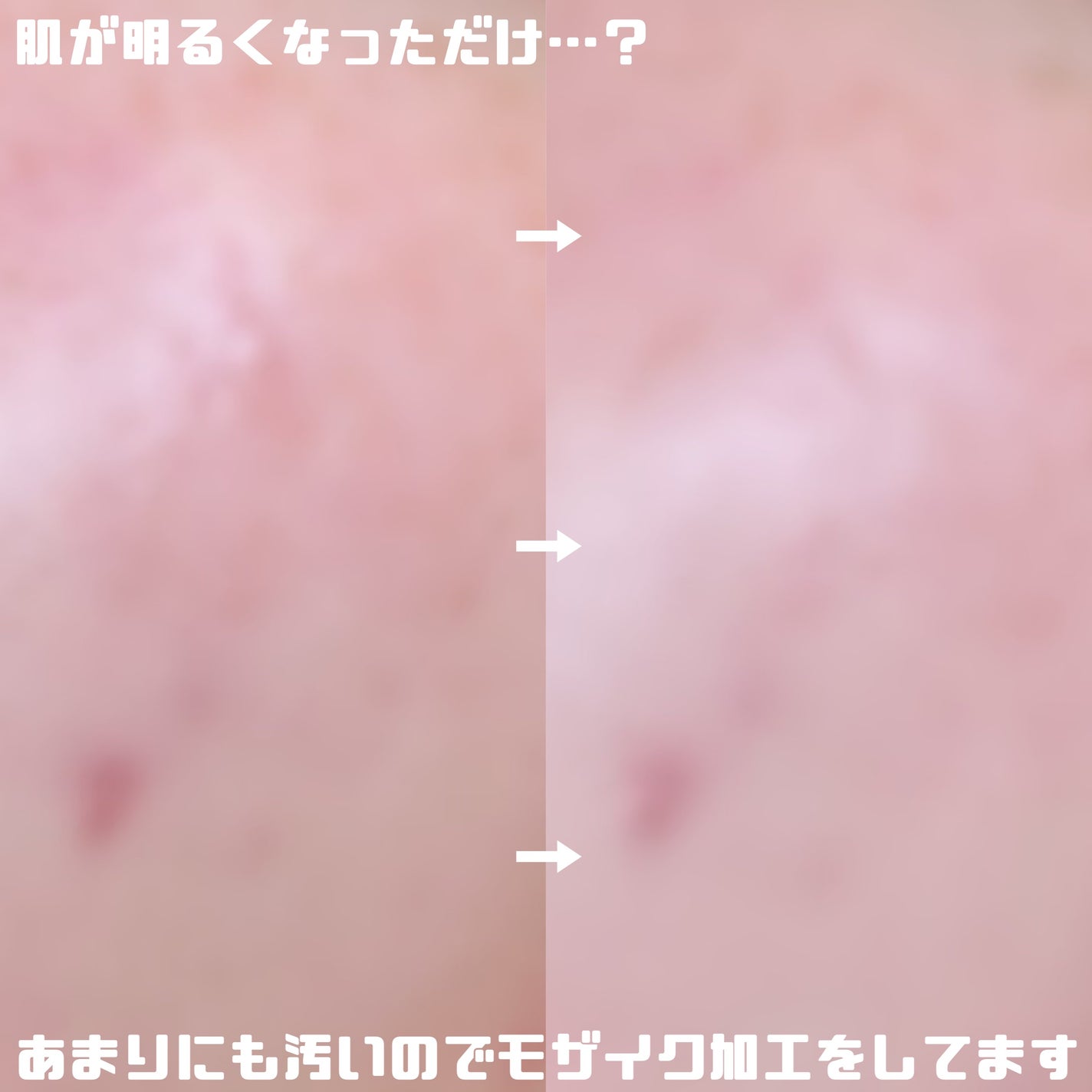 ダブル セラム バーム ファンデーション/Dr.Althea/クリーム・エマルジョンファンデーションを使ったクチコミ(4枚目)