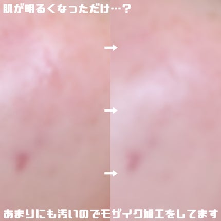 ダブル セラム バーム ファンデーション/Dr.Althea/クリーム・エマルジョンファンデーションを使ったクチコミ(4枚目)