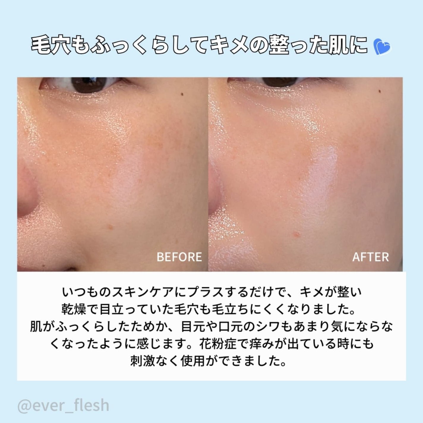 ナオホリック on LIPS 「72時間続く保湿力?!白樺の水分でしっとり肌🩵********..」(5枚目)