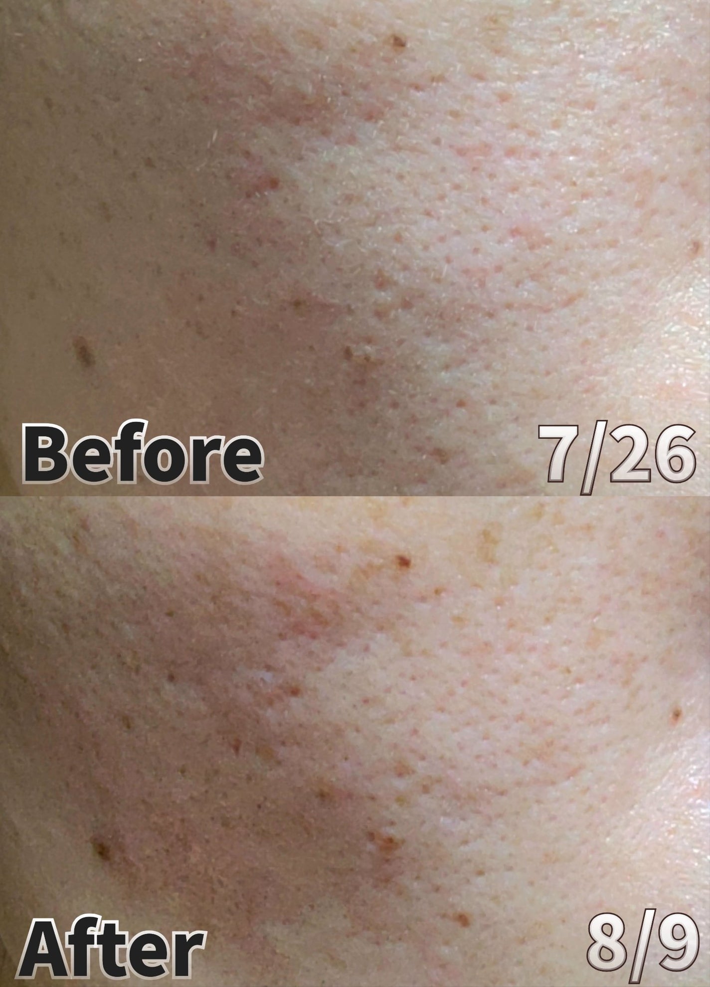 パンテショット675/COSNORI/美容液を使ったクチコミ(2枚目)