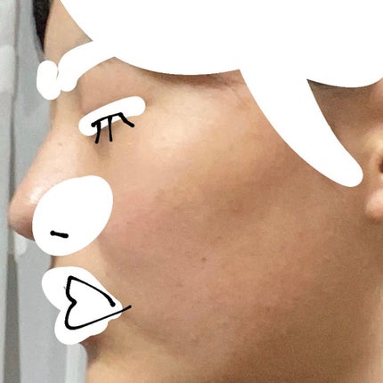 ティーツリーケア ソリューション エッセンシャルマスクEX/MEDIHEAL/シートマスク・パックを使ったクチコミ(3枚目)