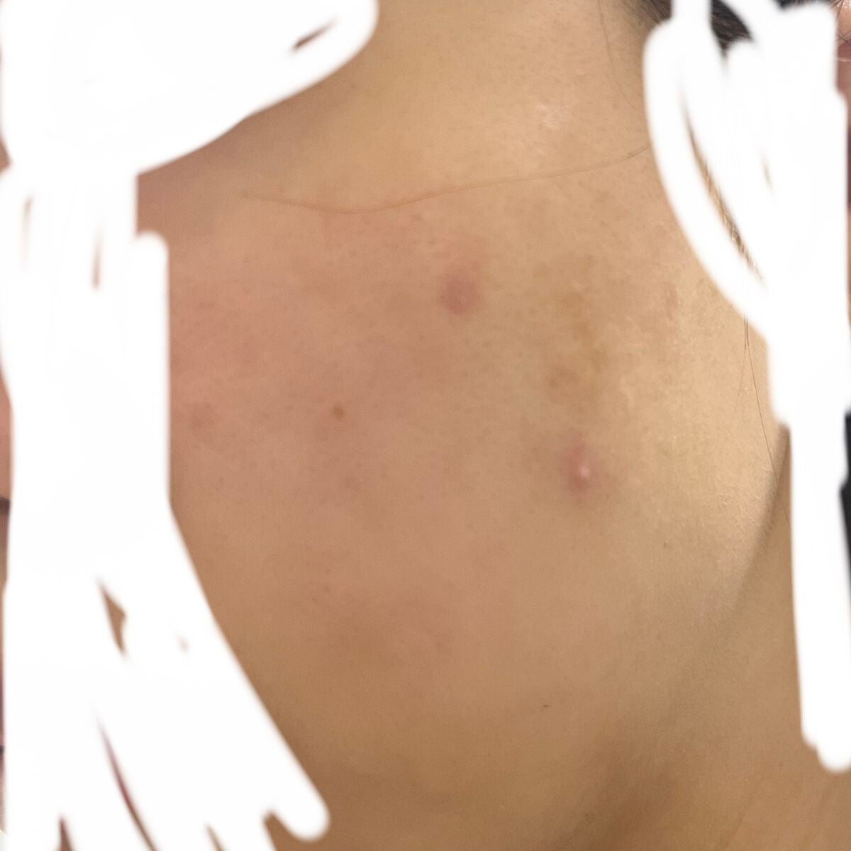 ð£ on LIPS ã4æ¥ç®ïŒç®èç§ã¯1æ¥ç®ïŒãŸãéãåºããŠããã¯ãªã³ããã€ã·ã³ã²ã«..ãïŒ4æç®ïŒ