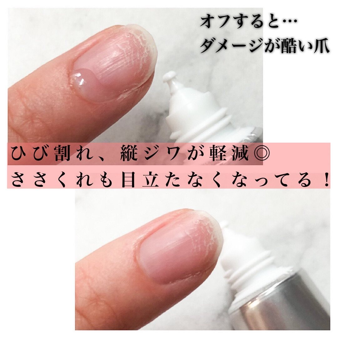 ドロップリペアセラム/ネイルネイル/ネイルオイル・トリートメントを使ったクチコミ（2枚目）