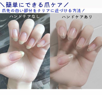 エテュセ クイックケアコート/ettusais/ネイルオイル・トリートメントを使ったクチコミ(1枚目)