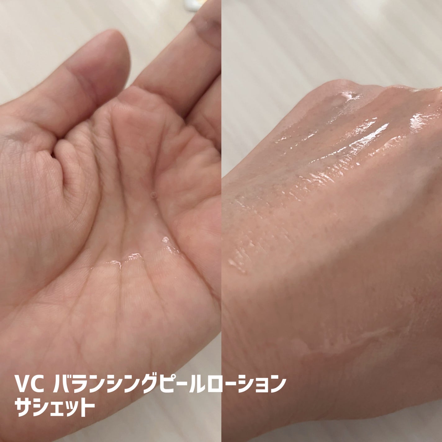 SKIOトライアルキット/SKIO/トライアルキットを使ったクチコミ(3枚目)