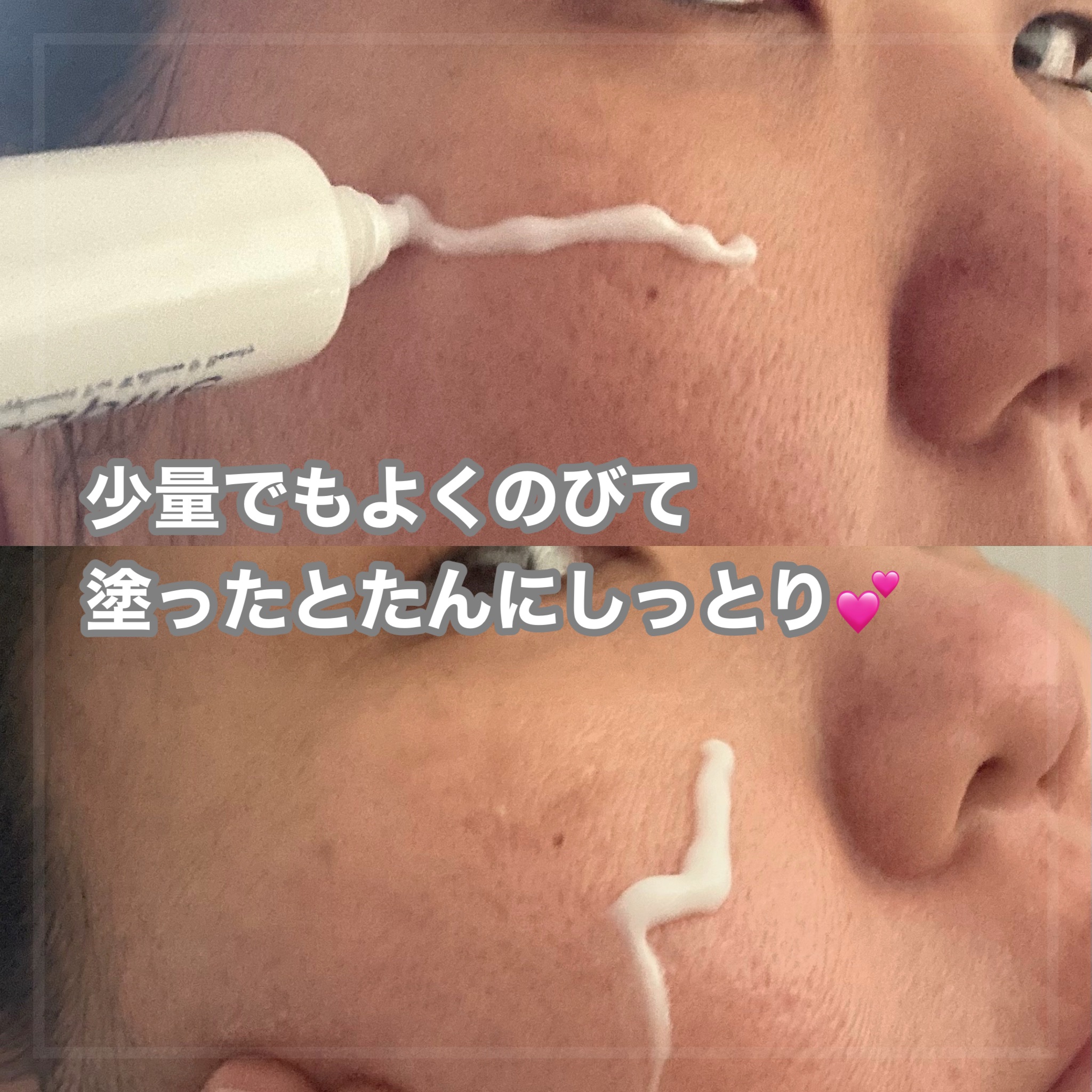 薬用トラネージュ/サプライフ/フェイスクリームを使ったクチコミ（2枚目）