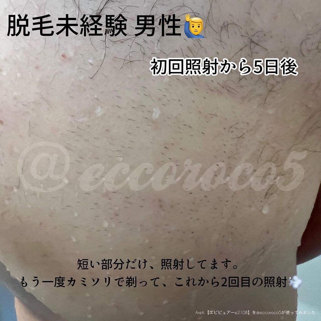 エピピュアーe2108/Areti./ボディケア美容家電を使ったクチコミ（3枚目）