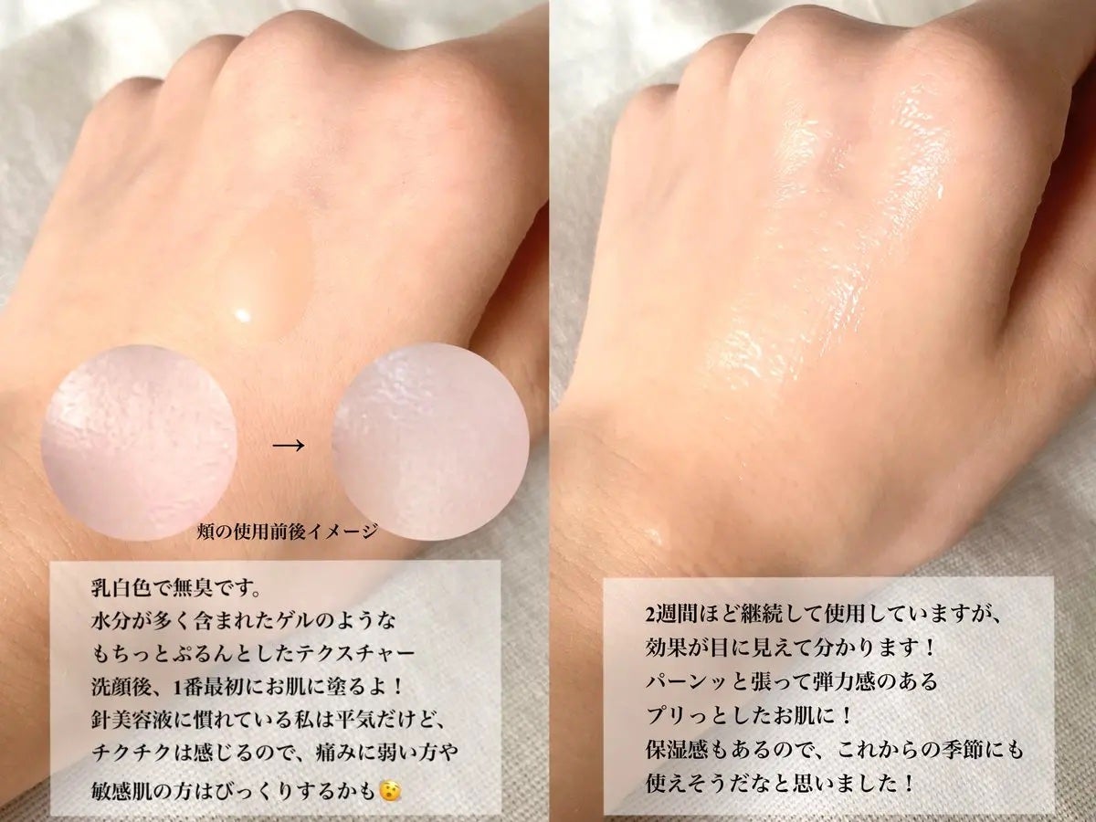 PDRNショット675/COSNORI/美容液を使ったクチコミ(3枚目)