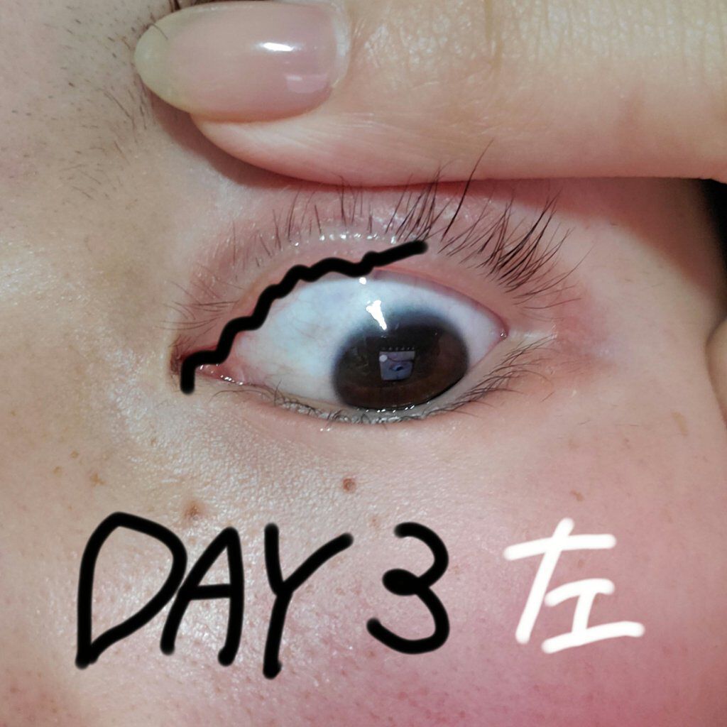 を使ったクチコミ（3枚目）