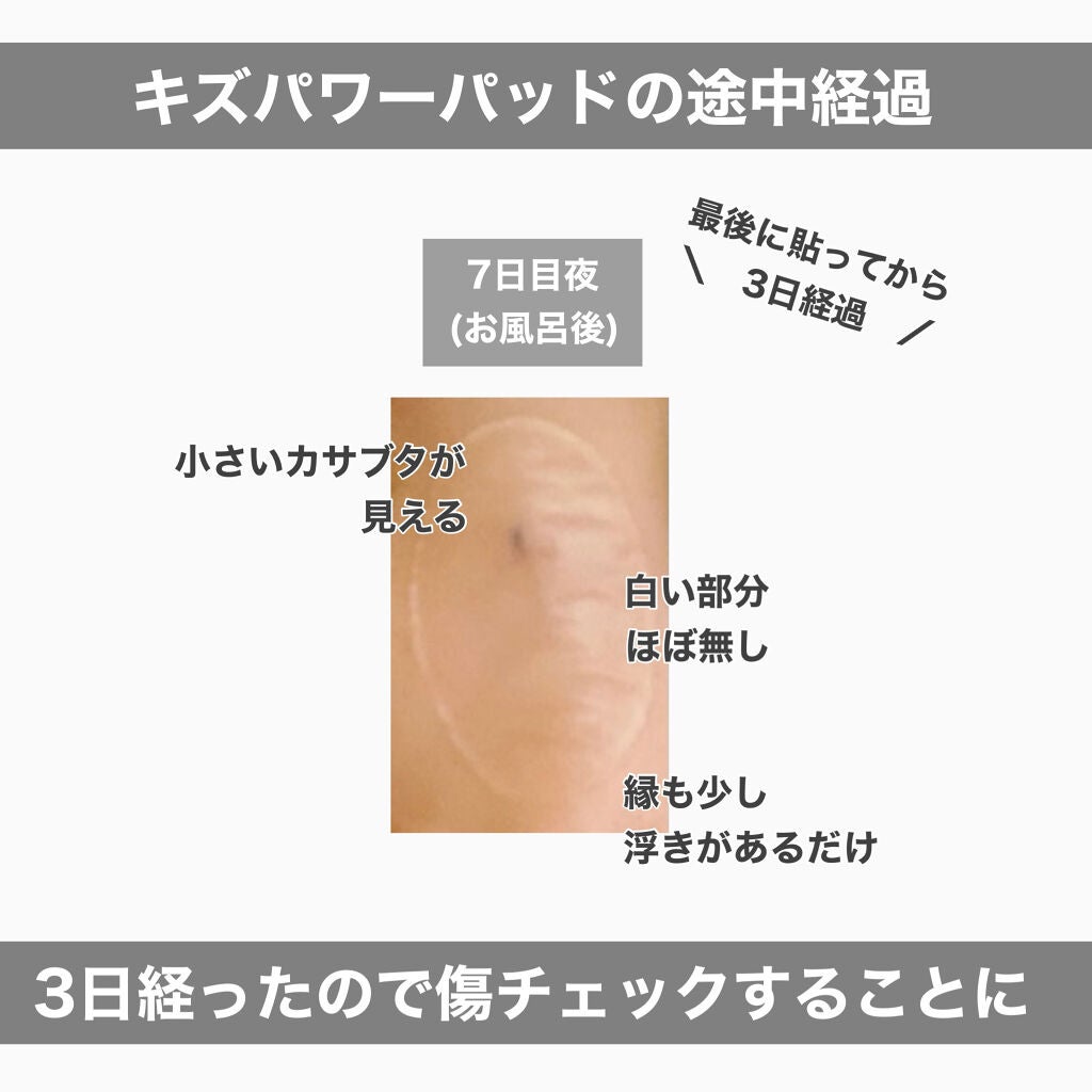 キズパワーパッド/バンドエイド/その他を使ったクチコミ(2枚目)