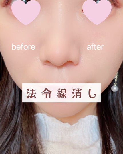 マスクフィットオールカバーデュアルコンシーラー/TIRTIR(ティルティル)/コンシーラーを使ったクチコミ(1枚目)