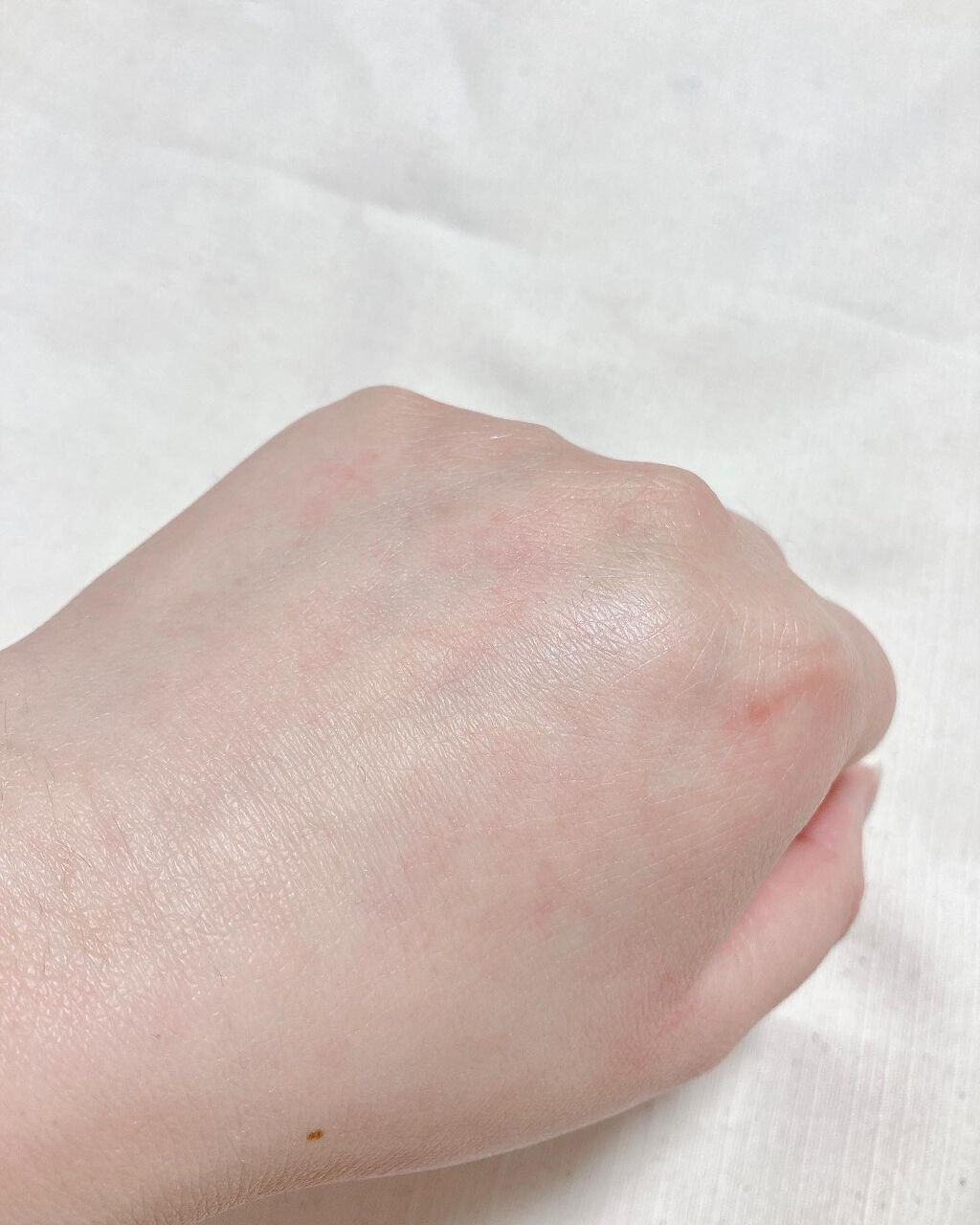 Bionist bio skin essence/Bionist (ビオニスト)/美容液を使ったクチコミ(6枚目)