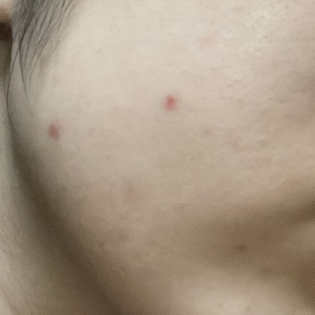 ジョンソンベビーオイル微香性/ジョンソンベビー/ボディオイルを使ったクチコミ（3枚目）