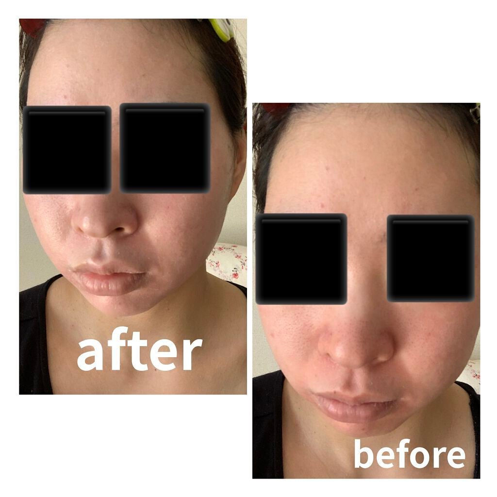 BSサンスクリーンSPF50/ZO Skin Health/日焼け止めクリームを使ったクチコミ(2枚目)