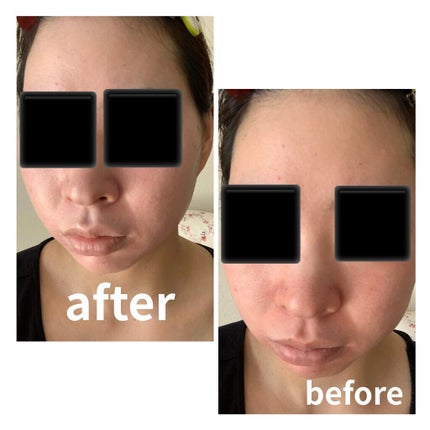 BSサンスクリーンSPF50/ZO Skin Health/日焼け止めクリームを使ったクチコミ(2枚目)