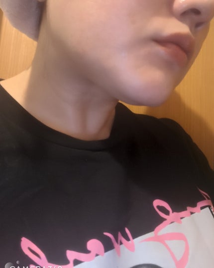 9番 NMNバイオリフトラッピングマスク/numbuzin/シートマスク・パックを使ったクチコミ(4枚目)