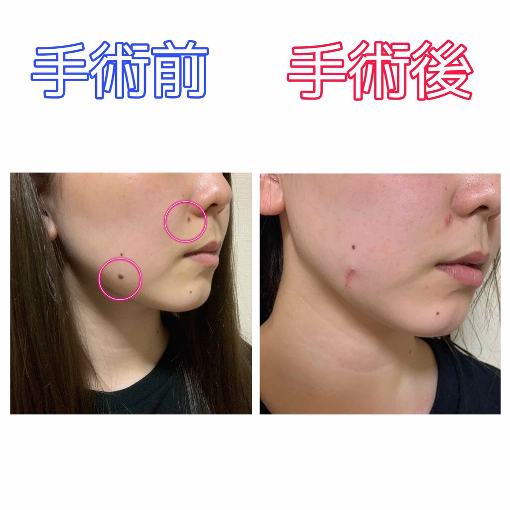 なずな on LIPS 「来世こそ推しと結婚だ〜!!!!皆様こんにちは、なずなです。ほく..」(2枚目)